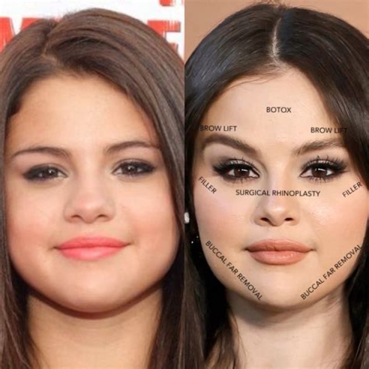 Did Nelly Furtado Get Plastic Surgery: Before & After!